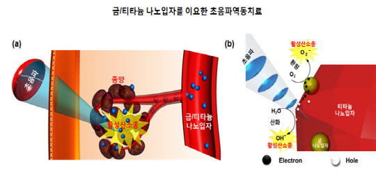 스마트 나노로봇을 이용한 초음파역동치료의 모식도(미래창조과학부 제공)